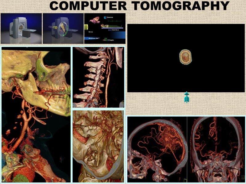 COMPUTER TOMOGRAPHY